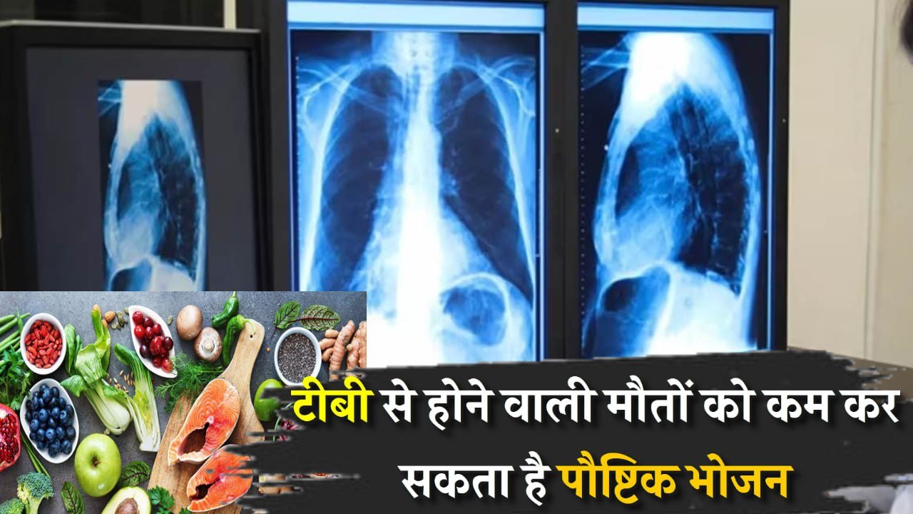 टीबी से होने वाली मौतों को कम कर सकता है पौष्टिक भोजन, 2035 तक बचाई जा सकती हैं हजारों की जिंदगी